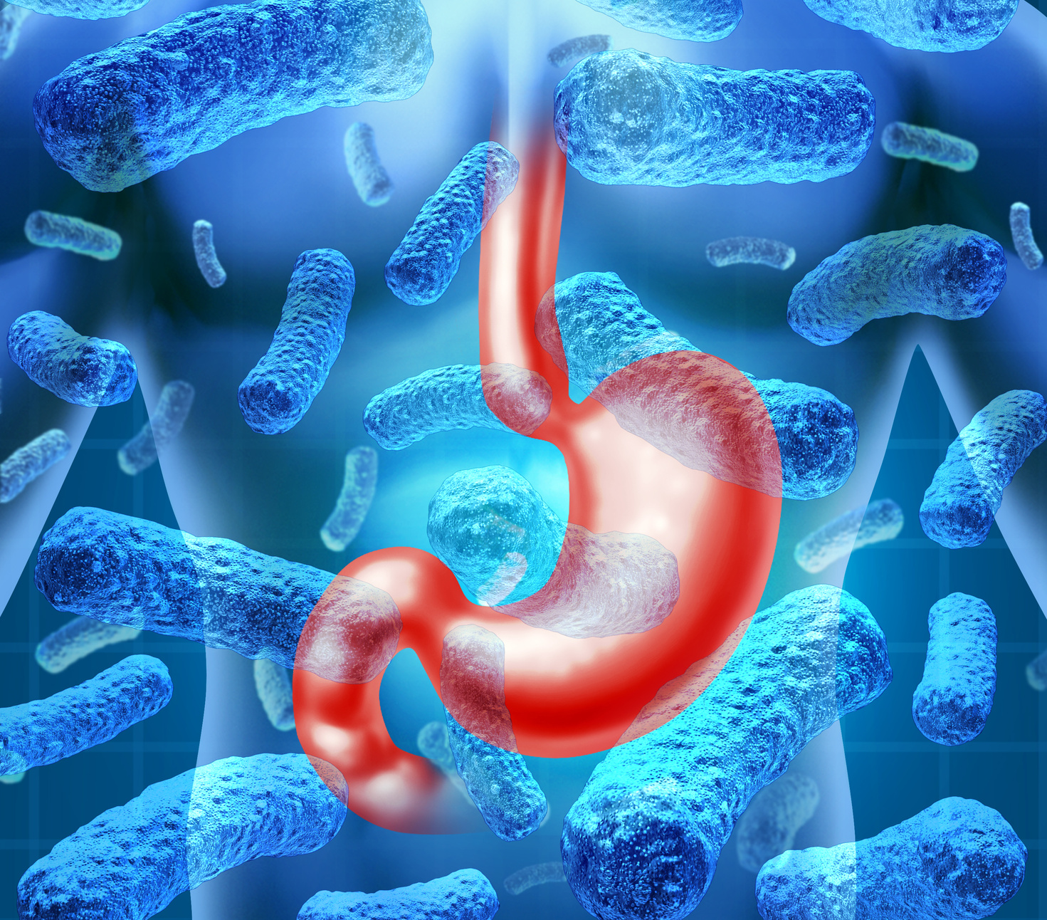 Stomach Infection Osservatorio Regionale Sicurezza Alimentare