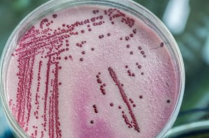 Pink and red microbacterias