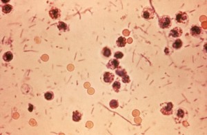 Shigella_stool